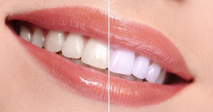 Aesthetic Dentistry
