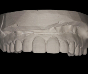 Prosthetics Prosthetics